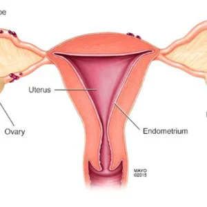 Comprehensive endometriosis care in Mumbai with experienced specialists